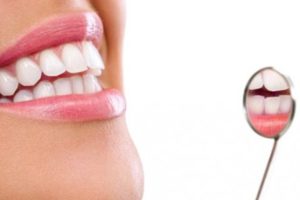 Foto de sorriso com clareamento dental e dentes mais brancos