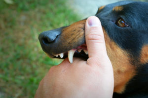 cachorro com raiva mordendo a pessoa