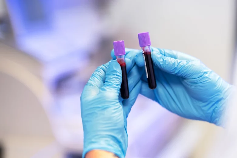 Frascos de coleta de sangue com foco no HCM, para análises laboratoriais para diagnósticos médicos.